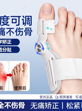脚趾拇指外翻矫正器大脚骨突出通用纠正器侧分趾器固定夜用足部