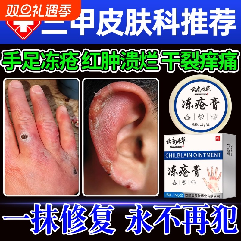 云南本草冻疮膏止痒冻伤膏正品官方旗舰店防冻裂手足冻耳朵伤消肿