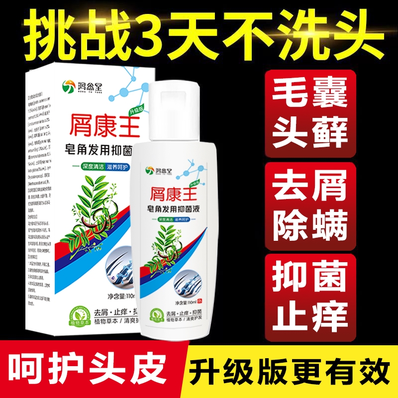 屑康王除螨大块洗发水脂溢性皮炎去屑毛囊炎止痒头皮屑洗头膏正品