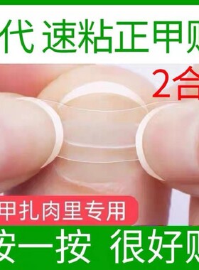 正甲贴片矫器内嵌扣德国沟卷
