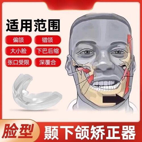 适用于颞下颌关节紊乱深覆合矫正