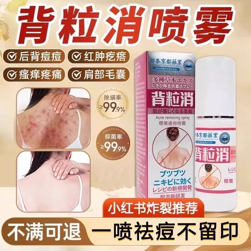 岑艾堂背粒消喷雾胸前胸后背祛痘痘除螨背部背后背长痘痘背部粉刺