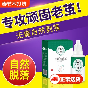 清茧灵老茧膏硬皮软化剂脚底根脚茧厚死皮脚垫神器眼鸡药水非去除