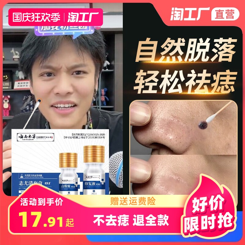 点痣膏无痕正品旗艦店祛痣脸部去淡斑非药水点斑水祛痣笔专用膏液怎么看?
