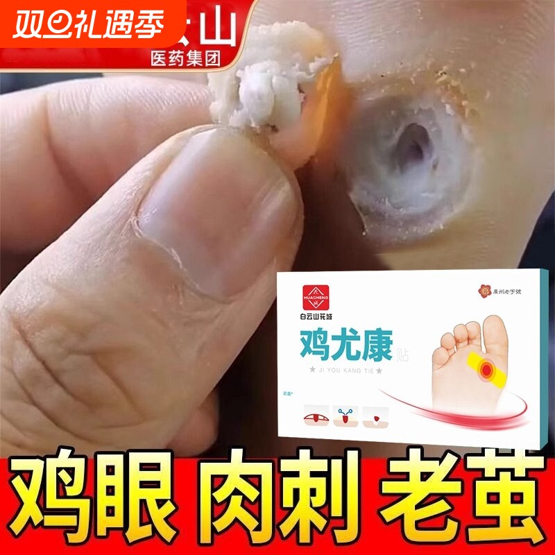鸡眼贴去鸡眼神器老茧鸡贴眼脚钉祛除膏鸡茧眼足部鸡贴眼膏正品