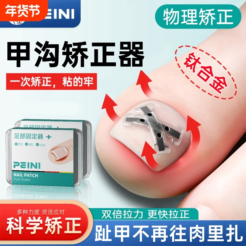 甲沟专用矫正器嵌甲纠贴片修脚趾甲剪刀钳不再往肉里长炎家用神器,家庭/个人清洁工具,美甲/修甲套装,淘宝优惠券,粉丝福利购,淘宝优惠卷