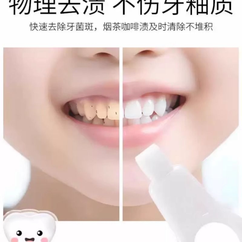 日本洁牙擦儿童去牙垢祛除牙黑斑牙渍神器牙齿污垢菌斑橡皮海绵擦