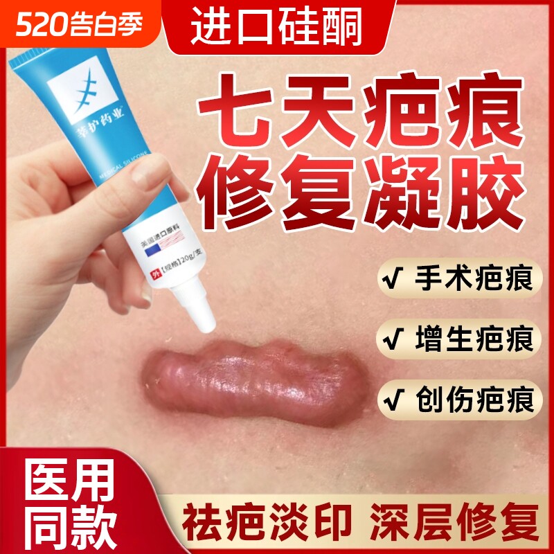 医用疤克祛疤膏去疤痕修复无痕硅凝胶除疤胶凝正品官方旗舰店