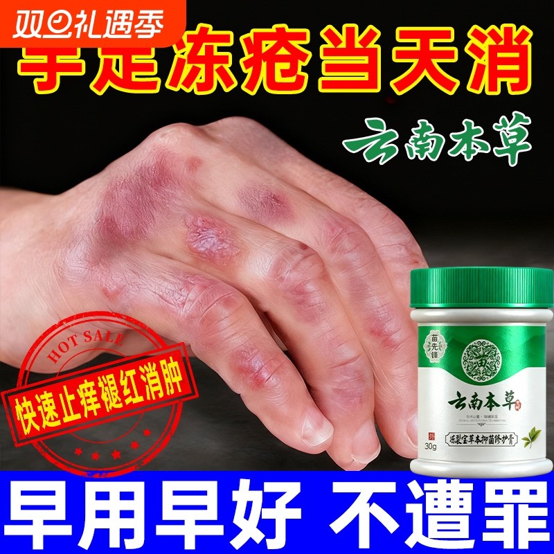 云南本草冻疮膏止痒冻伤膏防裂膏冻手足儿童耳朵正品官方旗舰店