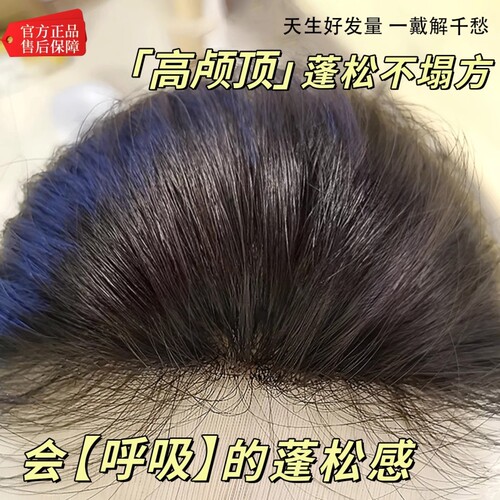 刘海假发女片头顶补发仿真自然前额隐形无痕蓬松高颅顶刘海假发片