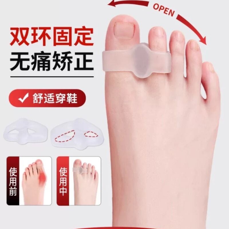 脚趾矫正器拇指外翻大母脚指分趾器软硅胶可以穿鞋分离大脚骨神器