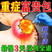 富贵包消除贴红外颈椎病肩周炎富贵包贴正品专用特效消除神器