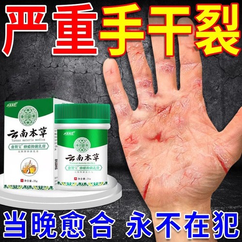 治手裂的药膏冬季防裂膏手足干燥干护手霜滋润保湿补水防干裂皲裂