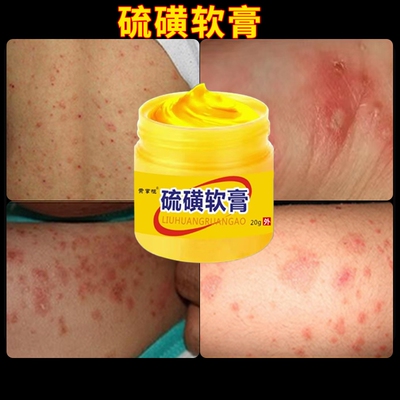 硫磺软膏外用皮肤瘙痒止痒