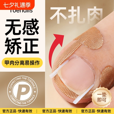 甲沟神器指甲矫正器嵌甲专用拉贴隔离脚趾甲长肉里填充垫片纠正炎
