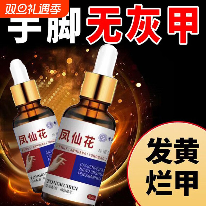 凤仙花灰指甲抑菌液膏香港灰趾指护理液脱甲正品药水同瑞草本增厚