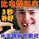 临时假牙自己补牙材料树脂牙齿缝义齿牙缝门牙牙模型冲洗家用牙科