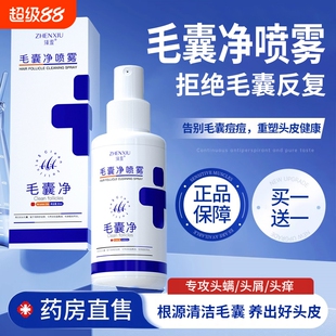 毛囊净喷雾剂毛囊炎护发头皮深层清洁头发干枯毛躁营养护理精华液