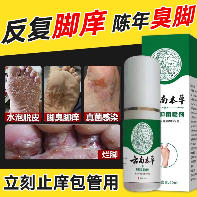云南本草脚部喷剂止痒脱皮杀菌真菌感染专用人气王正品官方旗舰店