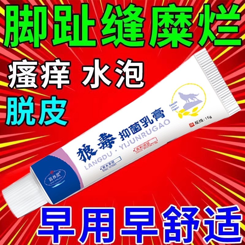 狼毒脚汽气膏止痒脱皮杀菌脚臭脚趾缝痒脚痒香港汗烂脚丫起泡正品