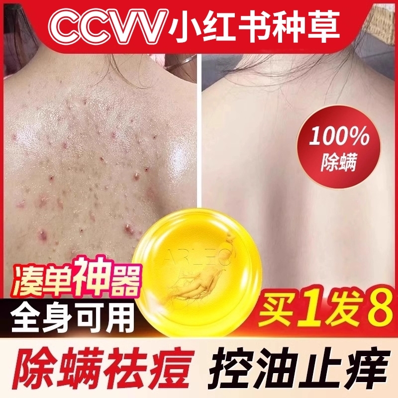 苦参除螨皂硫磺香皂男祛痘人参去螨虫手工皂洗脸皂洗澡沐浴背部女