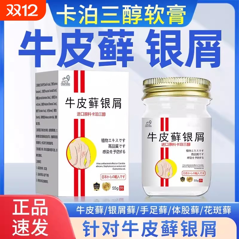 卡泊三淳软霜顽固性全身牛皮癣银屑病皮炎止眻湿疹皮肤正品
