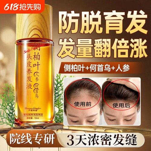 【纯中药熬制】防脱育发液第一名