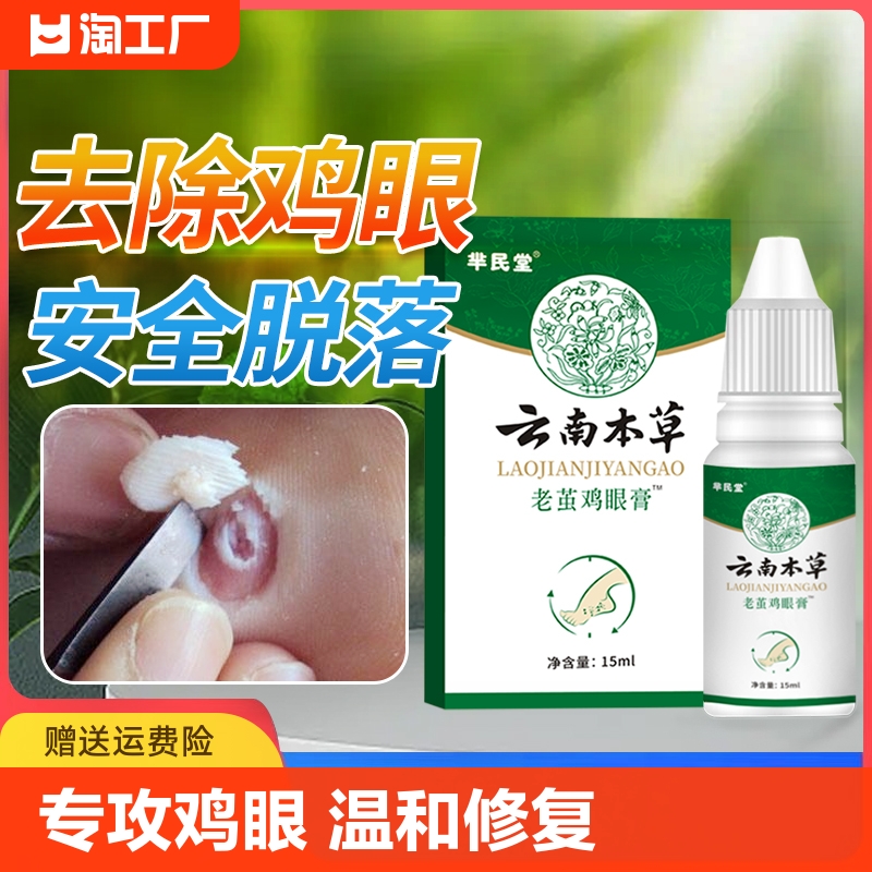 云南本草老茧鸡眼膏贴去脚底肉刺鸡眼贴鸡眼膏去除液角质草本修复 保健用品 足部健康 原图主图