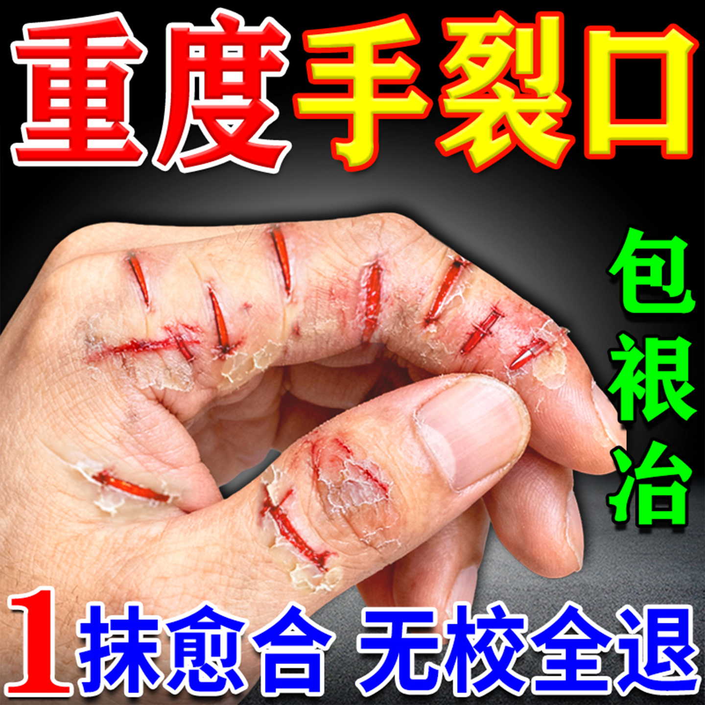 治手裂的药膏手裂口子干燥粗糙爆干皮防裂膏手足干裂皴裂膏手脱皮