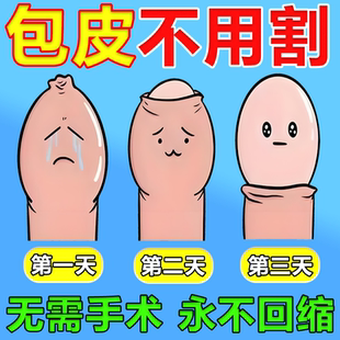 日本川井包皮阻复环外翻切除器脱落矫正男用隐形包茎凝胶医用过长