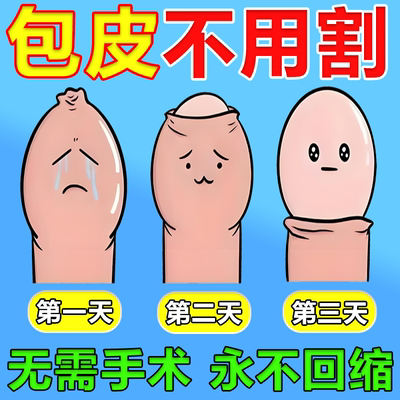 川井包皮阻复环、免切除包皮凝胶