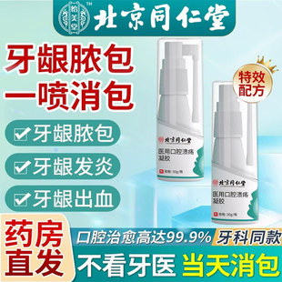 儿童牙龈脓包牙根发炎肿包肿痛消疼药牙周炎智齿牙疼炎上火喷雾