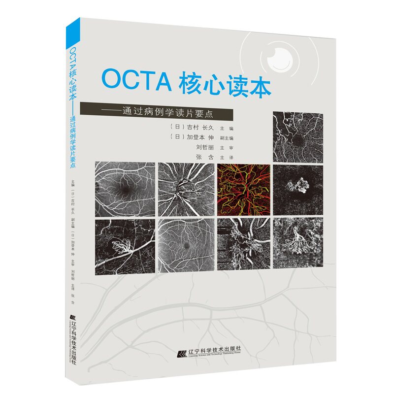 正版 OCTA核心读本 通过病例学读片要点糖尿病视网膜病变视网膜静脉阻塞青光限视神经疾病治疗眼底相干光层析血管成像术眼科学书籍