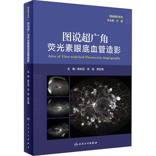 图说超广角荧光素眼底血管造影 图说眼科系列 超广角眼底成像术 oct眼底病检查技术 眼科学 眼科疾病治疗书籍 超广角眼底自发荧光