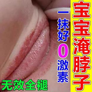 宝宝淹脖子神器婴幼儿腋下大腿防湿热疹护臀膏专用护臀霜屁屁霜