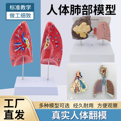 蓝蝶模型呼吸系统肺解剖病理肺
