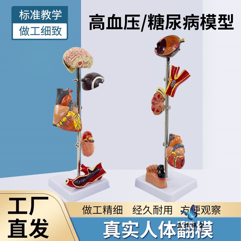 蓝蝶模型糖尿病器官并发症