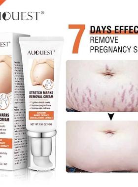 Creme corporal Remove Pregnancy Scars Acne Cream Stretch Mar