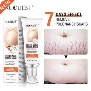 Creme corporal Remove Pregnancy Scars Acne Cream Stretch Mar