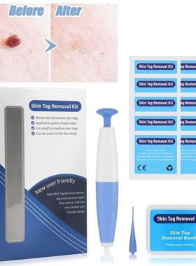 1 Set Skin Tag Remover Home Use Adult Painless Skin Tag Remo