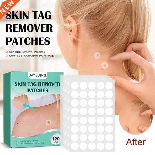 120pcs Skin Tag Remover Patch Wart Treatment Stickers Quick