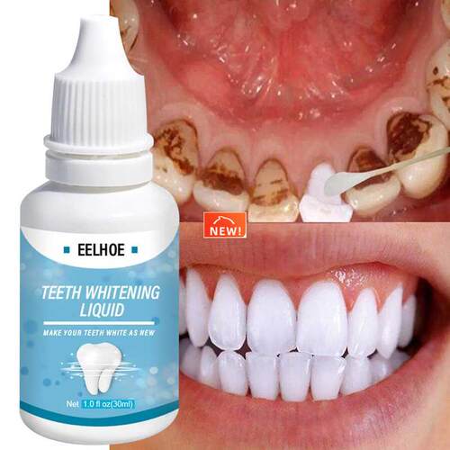 Teeth Whitening Essence Liqud Oral Hygiene Cleaning Whiten
