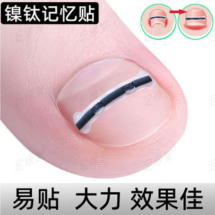甲艺矫正钢丝钢片甲沟贴片正甲贴物理拉平镍钛记忆钢丝指甲扎肉炎