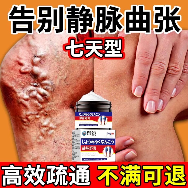 正品静脉曲张腿部青筋凸起蚯蚓腿血管肿胀红血丝医用脉舒小腿贴膏