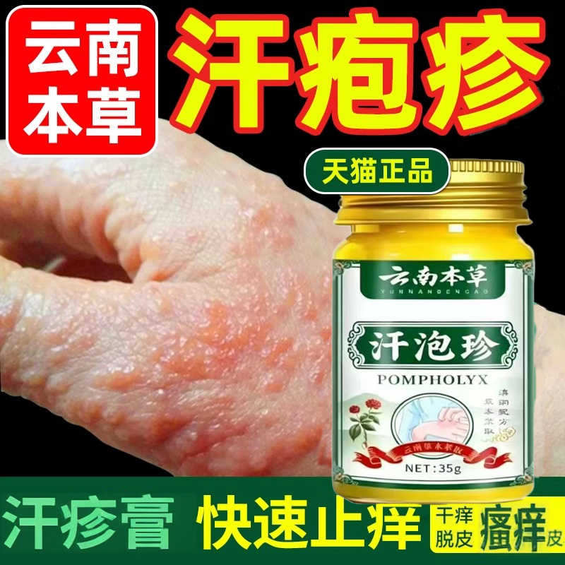 手上起小水泡孢疹专用软膏汗泡疱疹膏状止痒汉真菌汗泡疹湿疹正品