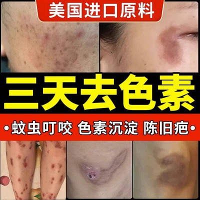 黑色素沉淀疤痕修复除疤