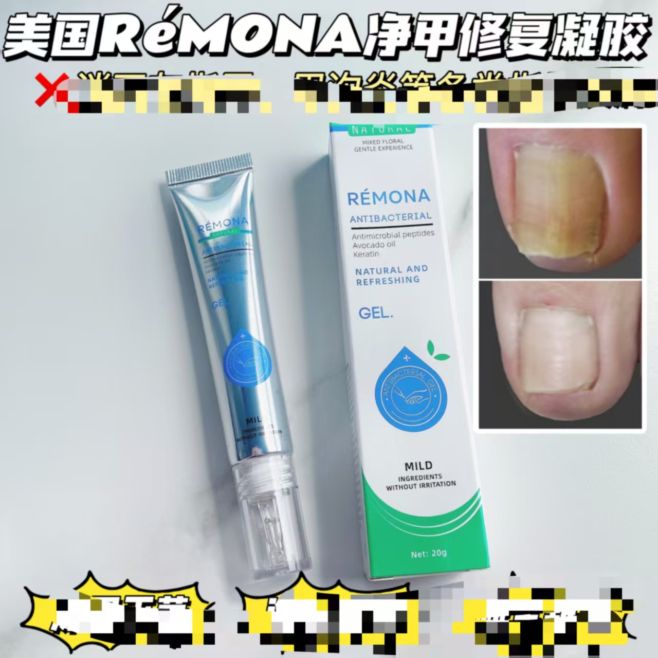 美国原装进口REMONA净甲修复凝胶滋养水杨酸20g/支FL