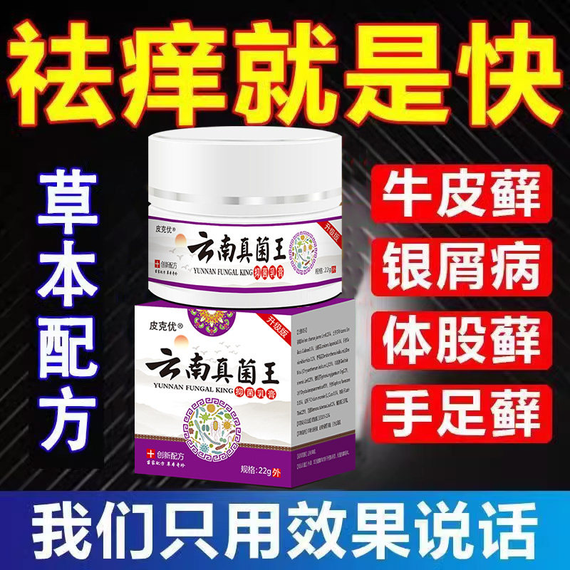 云南白百草真菌王药袪痒快速断痒全身干外用断痒膏皮肤瘙痒特药,洗护清洁剂/卫生巾/纸/香薰,身体乳液,淘宝优惠券,粉丝福利购,淘宝优惠卷