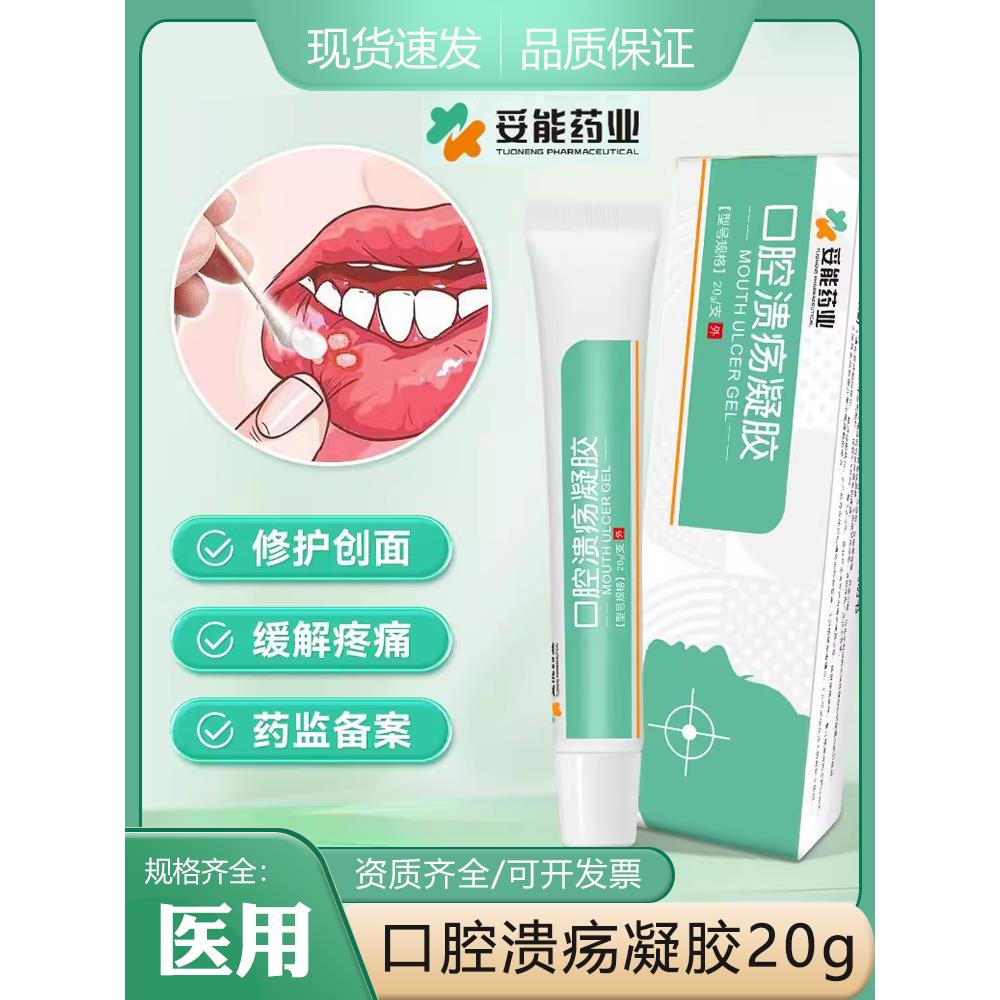 妥能药业口腔溃疡凝胶一点