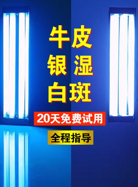 窄谱中波紫外线UVB311nm白斑白癜牛皮银湿屑308nm波长准分子光灯